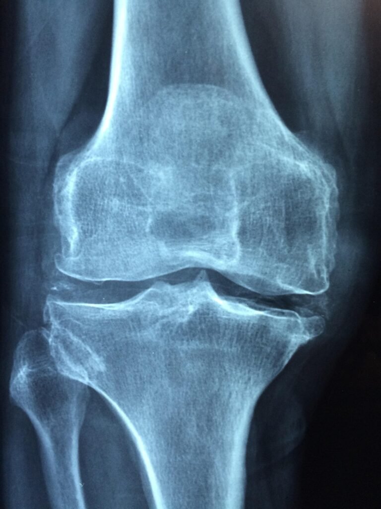 Arthritis & Joint Health