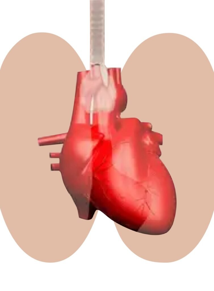 Heart Attack & Stroke
